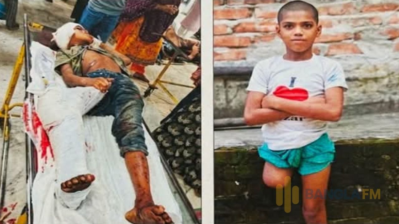  পা কাটা রায়হানের সেইদিন কি ঘটেছিল, বেরিয়ে আসলো চাঞ্চল্যকর তথ্য