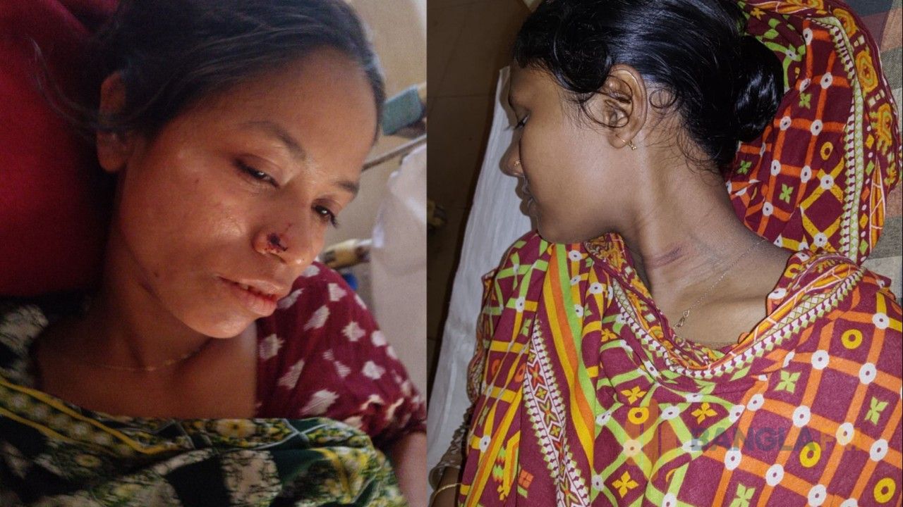 পীরগাছায় অন্তঃসত্ত্বা নারীসহ চারজনকে পিটিয়ে জখমের অভিযোগ