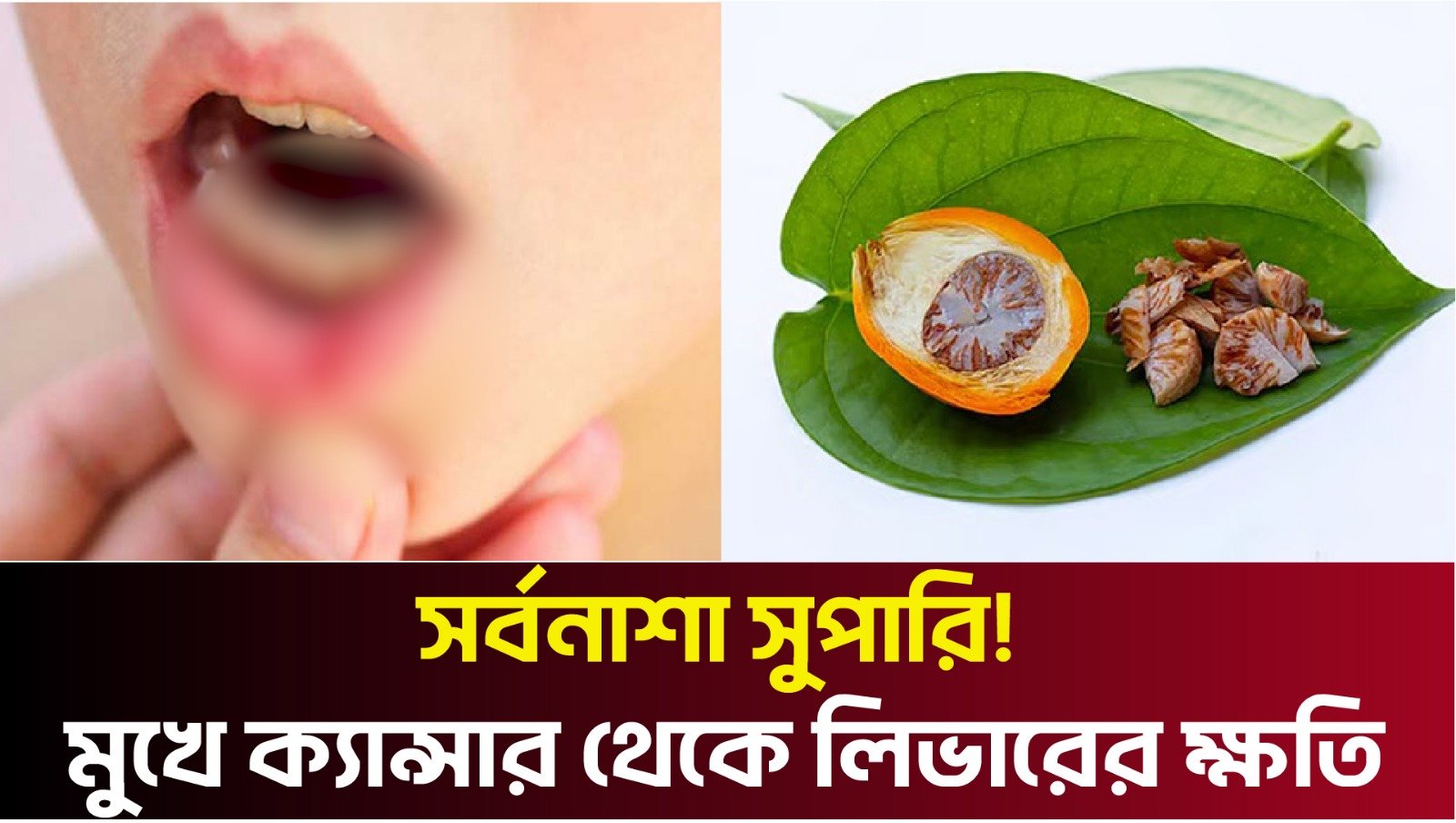 সর্বনাশা সুপারি! মুখে ক্যান্সার থেকে লিভারের ক্ষতি—জানুন ভয়াবহ স্বাস্থ্যঝুঁকি