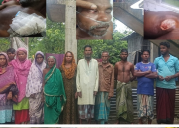 আসামিদের জামিনে মুক্তির প্রতিবাদে গৌরারংয়ে মানববন্ধন  এবং ভুক্তভোগী