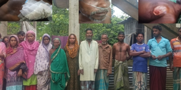 আসামিদের জামিনে মুক্তির প্রতিবাদে গৌরারংয়ে মানববন্ধন  এবং ভুক্তভোগী