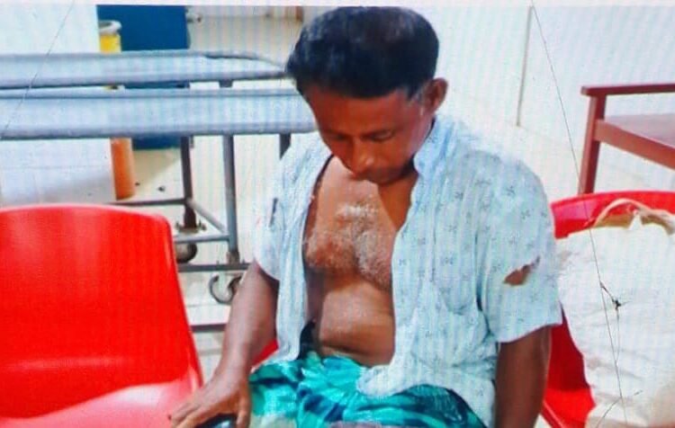 কৃষকের পা ভেঙ্গে দিলো হাতুরি দিয়ে