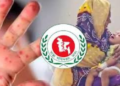 থামছেই না হামের মৃত্যু, ২৪ ঘণ্টায় আরও ৫ প্রাণহানি