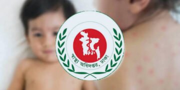 সিলেটে হামের প্রকোপে আরও ৩ শিশুর মৃত্যু