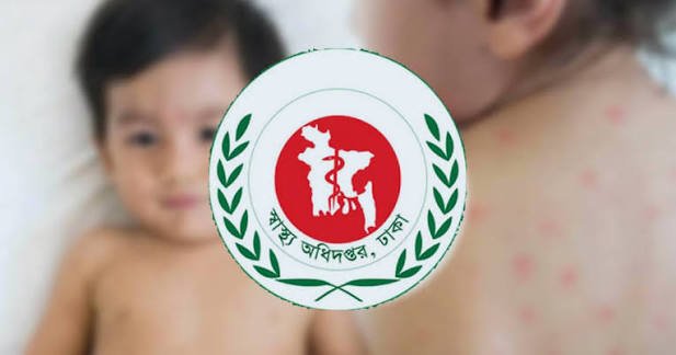 সিলেটে হামের প্রকোপে আরও ৩ শিশুর মৃত্যু