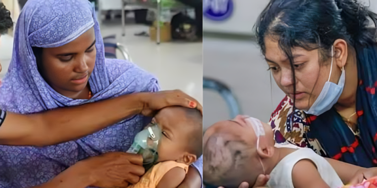 দেশে হাম ও উপসর্গে আরও ৩ শিশুর মৃত্যু, মোট প্রাণহানি ৭৫০