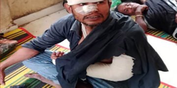 বেনাপোলে বড় ভাইকে কুপিয়ে জখম করেছে ছোট ভাই