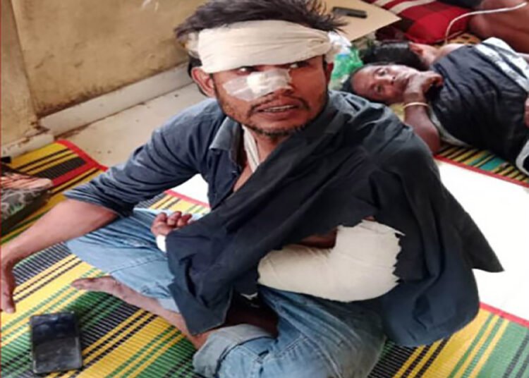 বেনাপোলে বড় ভাইকে কুপিয়ে জখম করেছে ছোট ভাই